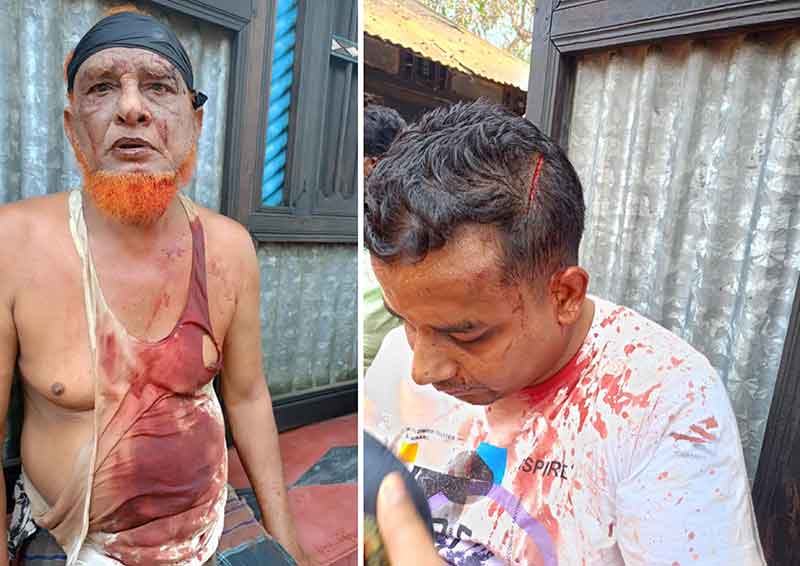 কচুয়ায় রান্নাঘরের ধোঁয়া নিয়ে বিরোধ, সাবেক ইউপি সদস্য ও প্রবাসী ছেলের ওপর হামলা