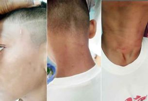 ব্রাহ্মণ সাখুয়ায় শিশু নির্যাতনের অভিযোগ, থানায় মামলা