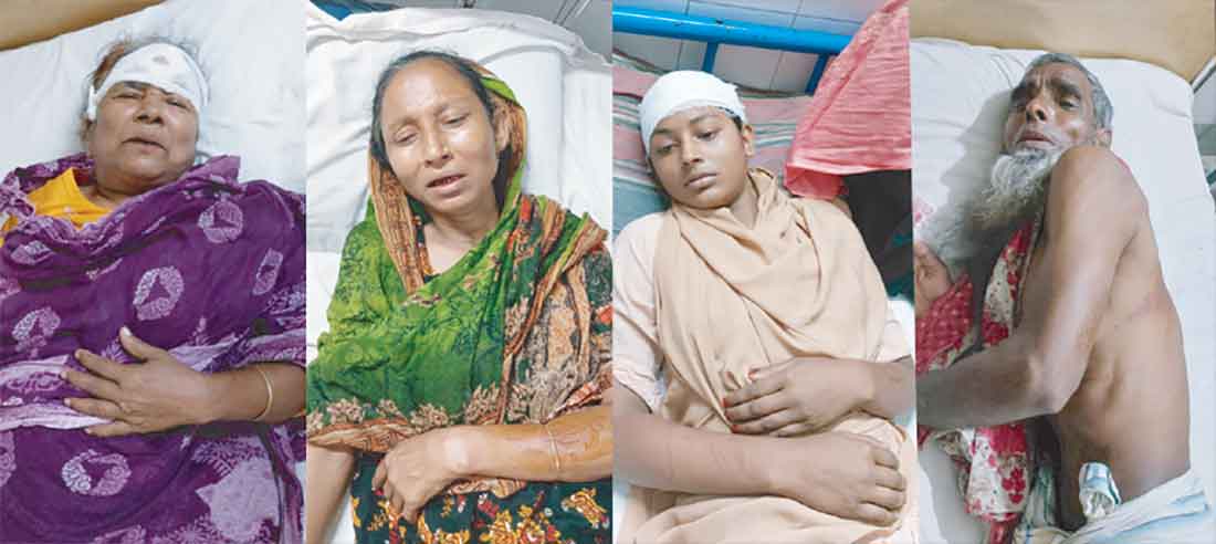 হাজীগঞ্জে জমি বিরোধের জেরে এসএসসি পরীক্ষার্থীসহ একই পরিবারের চারজন আহত