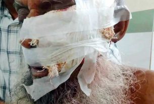 হাজীগঞ্জে শিয়ালের হঠাৎ হামলায় ১০ গ্রামবাসী আহত