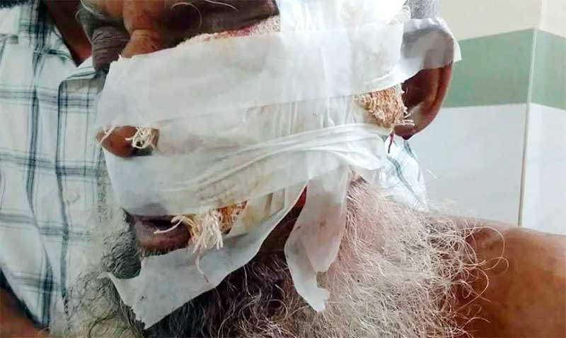 হাজীগঞ্জে শিয়ালের হঠাৎ হামলায় ১০ গ্রামবাসী আহত