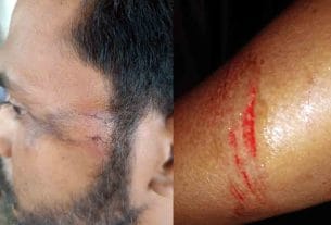 আশিকাটিতে জমি মাপজোক নিয়ে সংঘর্ষ, নারীসহ আহত ৩