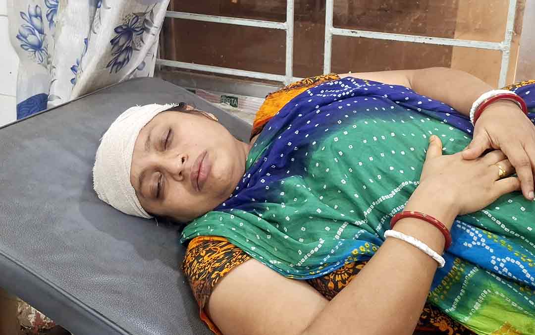 ফরিদগঞ্জে জমি বিরোধে কুড়ালের আঘাতে নারী আহত